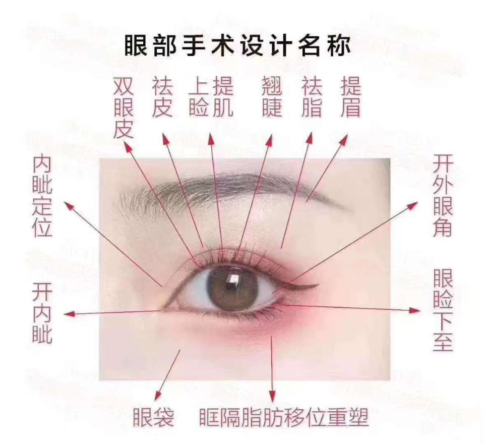 割双眼皮关注最好的7大问题(图1)